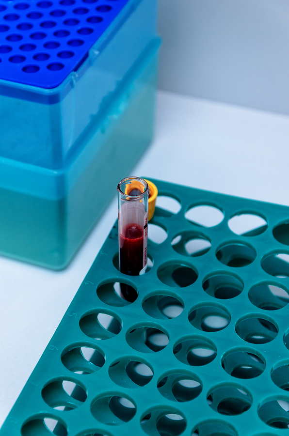 NeoGenomics Buys Oncology Lab Genoptix